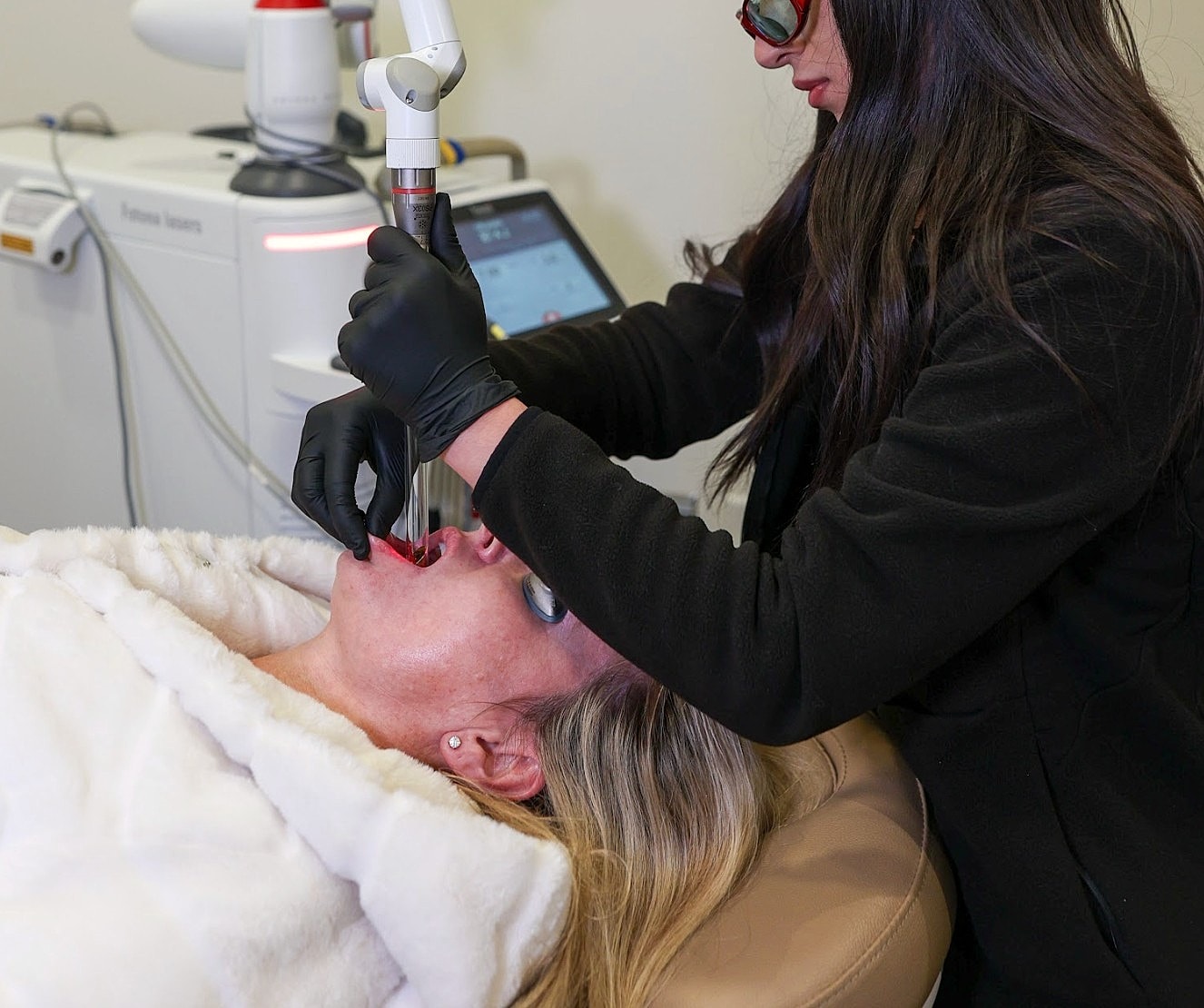 Laser treatment session for facial rejuvenation.