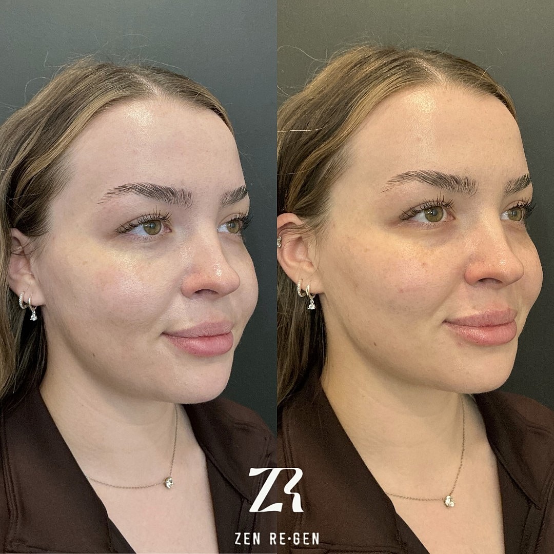 Before and after skin treatment portrait.