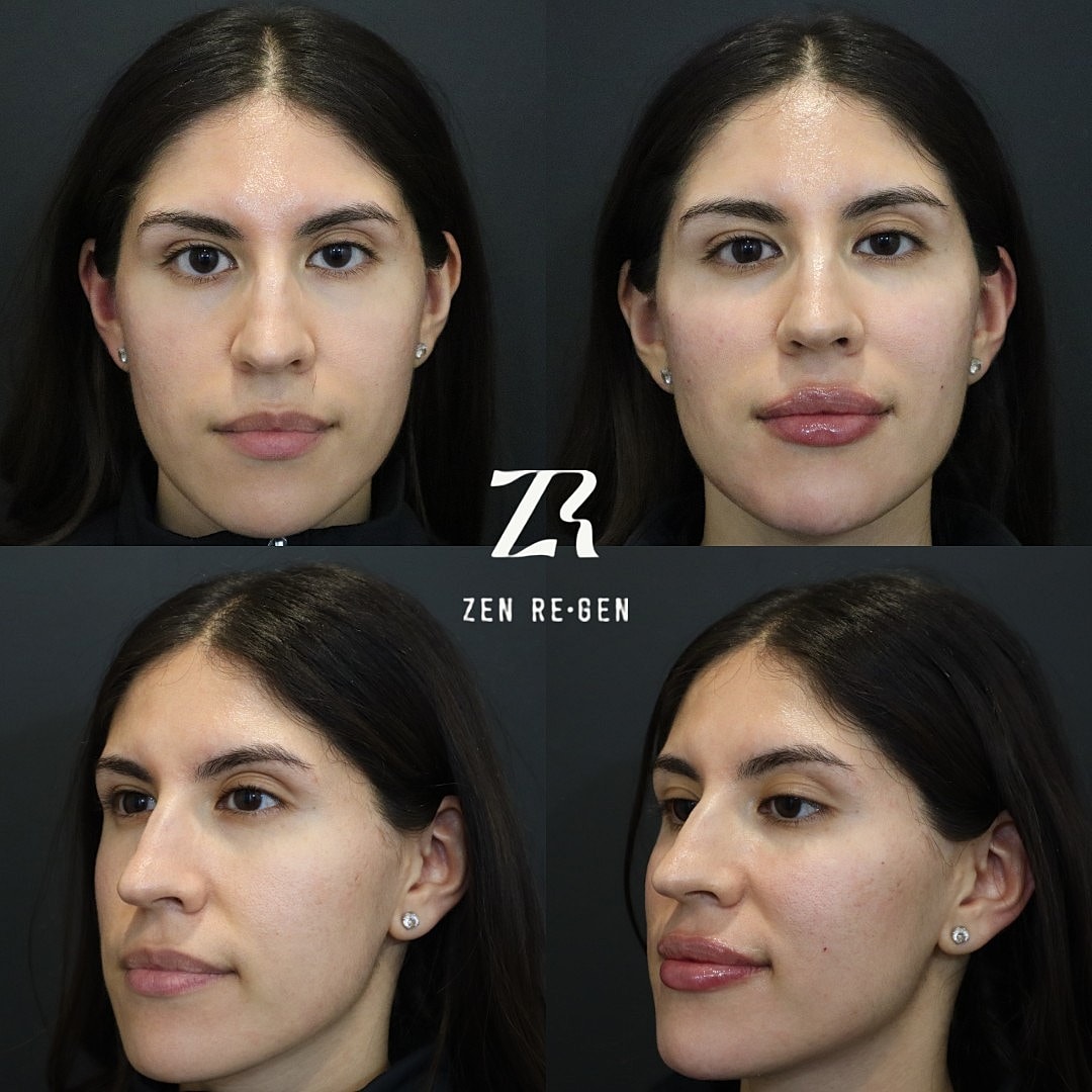 Before and after beauty treatment showcase.