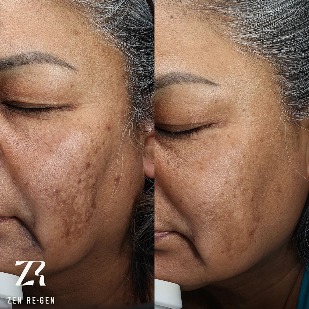 Before and after skin treatment results.