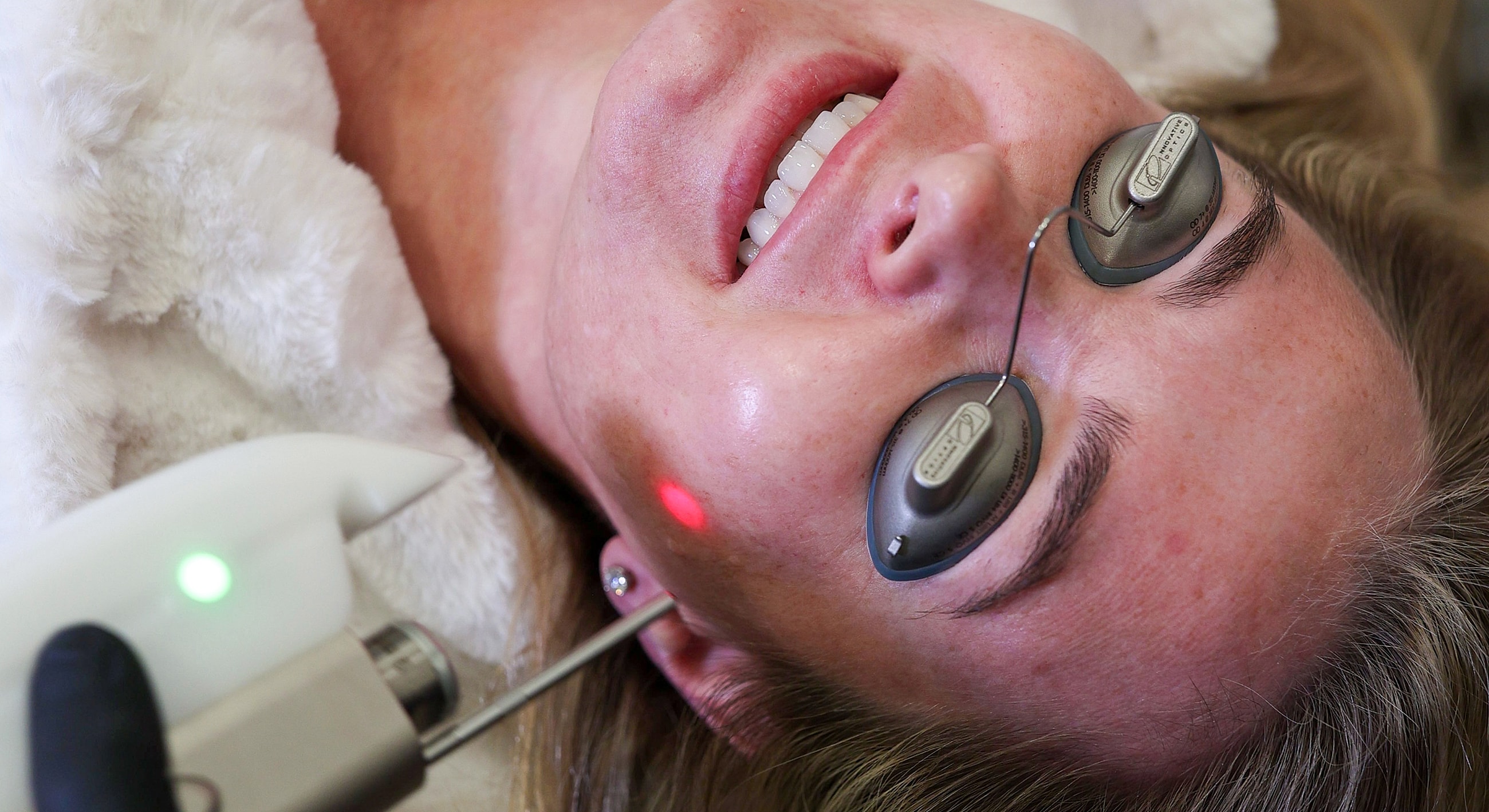 Woman receiving cosmetic laser treatment on face.